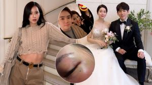 Kim Jung Hoon Sexual Assault Case: Jisoo's Brother EXPOSED? Wife’s Domestic Abuse Pics Spark Online Chaos