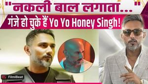 Yo Yo Honey Singh Reveals Why He Went Bald Due To Medicines, Makes Shocking Confessions!