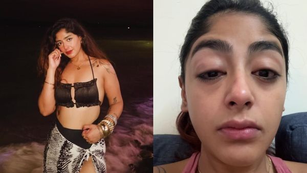 MTV Splitsvilla 16 Fame Preet Singh Assaulted By Influencer, Says 'I Was Hit So Badly...' - SHOCKING VIDEO