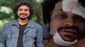 కళ్లు తెరిచేసరికి హాస్పిటల్‌లో... యాక్సిడెంట్‌పై పండు మాస్టర్ ఫస్ట్ రియాక్షన్