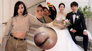 Kim Jung Hoon Sexual Assault Case: Jisoo's Brother EXPOSED? Wife's Domestic Abuse Pics Spark Online Chaos