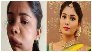 റൂട്ട് കനാല്‍ സര്‍ജറി ചെയ്തതിലെ പിഴവ്; മുഖം പോലും തിരിച്ചറിയാതെ തെന്നിന്ത്യന്‍ നടി സ്വാതി സതീഷ്