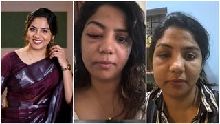 നീര് വന്ന് മുഖം മത്തങ്ങ പോലെയായി, കണ്ണ് തുറക്കാന്‍ പറ്റാതെ അടഞ്ഞു! പെട്ടെന്നുണ്ടായ അസുഖത്തെ പറ്റി വീണ
