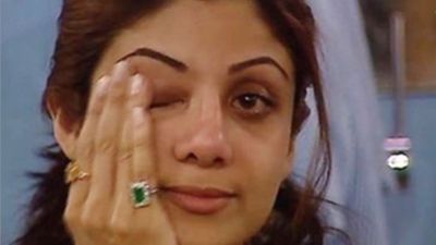 पीठ जल गई फिर भी शूटिंग की... शिल्पा शेट्टी ने किया चौंकाने वाला खुलासा, बताई उस रात की दर्दनाक कहानी