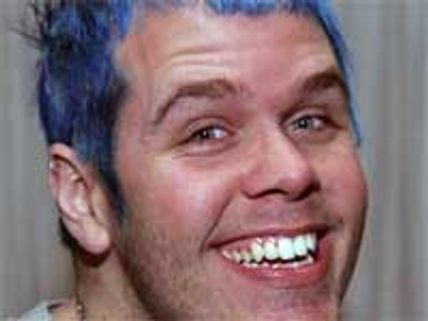 Perez Hilton allegedly beaten bloody by will.i.am 