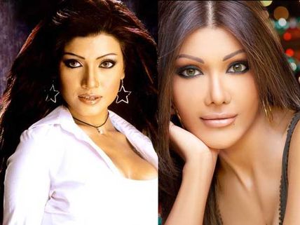 Kangna, Juhi, Koena: Bollywood's plastic surgery disasters!