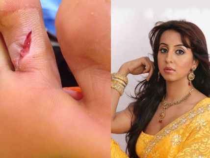 Actress Sanjjanaa Injured