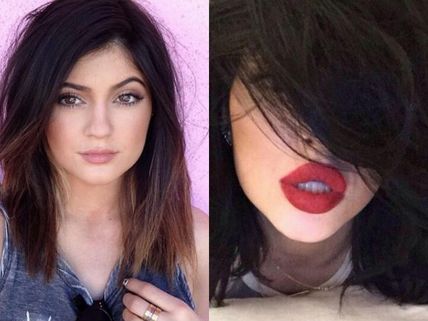 Kylie Jenner Responds To Her Lip Surgery Rumours