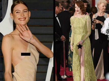 Emma Stone & Behati Prinsloo Suffer Wardrobe Malfunction At Oscars