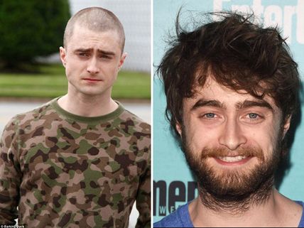 Daniel Radcliffe Shaved His Head, Goes Bald For Imperium