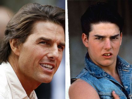 5 Hollywood Celebrities Who Have Gone Through Cosmetic Dentistry