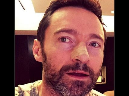 Hugh Jackman's Skin Cancer Procedures Continue: Gets Treated For The Fifth 