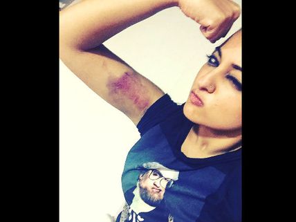 Ouch! Sonakshi Sinha Got Injured While Shooting For An Action Scene In 'Akira' 