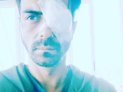 Arjun Rampal Suffers An Eye Injury! Is Left Disoriented