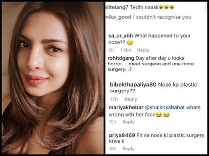 A Tale Of Plastic Surgery! Priyanka Chopra Gets Trolled Mercilessly For Her Alleged Nose Job! 