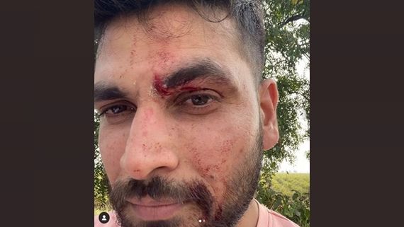 Bigg Boss Marathi 2 Winner Shiv Thakare Injured In Car Accident In Amravati