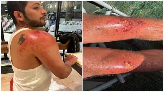 Khatron Ke Khiladi 12 Shoot Update: Nishant Bhat Gets Injured While Performing A Task; See Pics