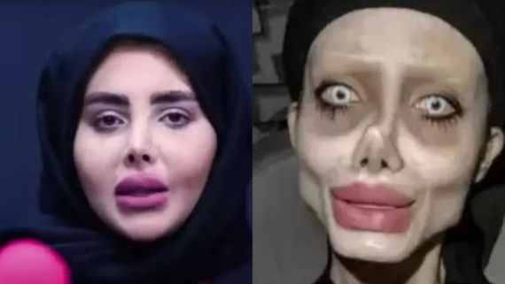 Iran's ‘Zombie Angelina Jolie', Sahar Tabar Reveals Viral Image Was Fake, Shows Her Real Face