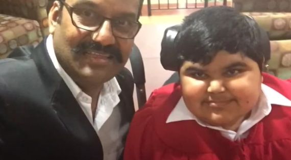 Napoleon’s Son Is Battling Muscular Dystrophy, Here’s Everything About The Disease