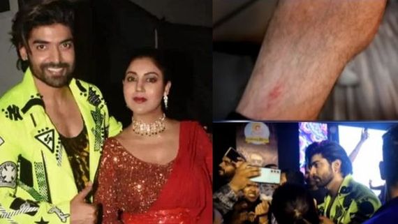 Gurmeet Choudhary Shows Off Injury He Got While Rescuing Debina From Mob, Netizens Say ‘Bht Bhynkr Injury....