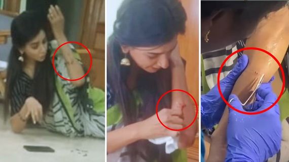 Baakiyalakshmi Jeni Injured During Shoot; Releases Behind The Scene Video As Proof