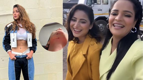 Khatron Ke Khiladi 13: Archana Gautam Cuts Her Chin, Aishwarya Sharma Bruises Arm- Celebs Who Got Injured