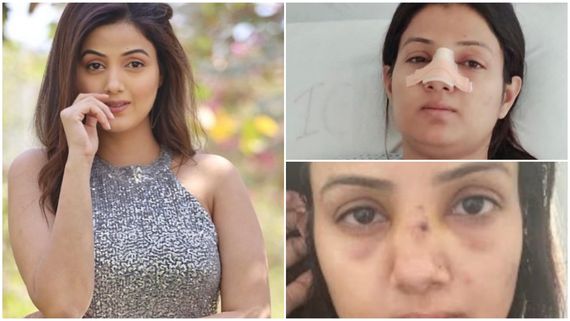 Yeh Hai Chahatein Fame Sumati Singh On Undergoing Nose Surgery After Devastating Incident: Was Totally Broken…