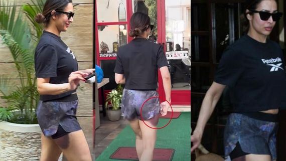 Funny How She Is Pretending To Cover…: Malaika Arora’s Latest Appearance With Big Bruise On Leg Grabs Eyeballs
