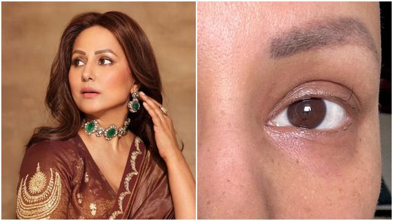 Hina Khan Health Update | Actress Nearing Last Cycle Of Chemo, Shares Pics Of Last Standing Eyelash: We Will…