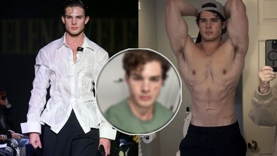 WHO Is Clavicular? Looksmaxxer Influencer New Pic Goes Viral After Overdose Hospitalization; Drops BIG Update