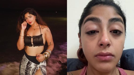 MTV Splitsvilla 16 Fame Preet Singh Assaulted By Influencer, Says 'I Was Hit So Badly...' - SHOCKING VIDEO