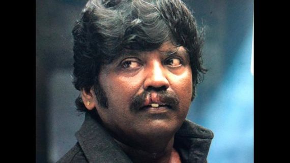 ಅಯ್ಯಯ್ಯೋ... ನಟ, ನಿರ್ದೇಶಕ ನಾಗಶೇಖರ್ ಗೆ ಇದೇನಾಯ್ತು.?