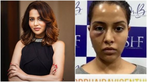 ಮಾಜಿ ಬಿಗ್ ಬಾಸ್ ಸ್ಪರ್ಧಿ ಫೇಶಿಯಲ್ ಅವಾಂತರ; ಹೇಗಿದ್ದರೂ ಈಗ ಹೇಗಾಗಿದ್ದಾರೆ ನೋಡಿ 