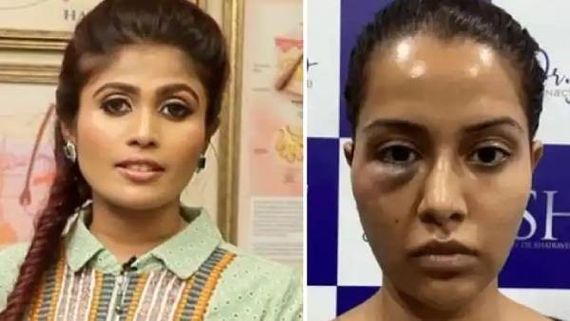 1 ಕೋಟಿ ಬೇಡಿಕೆಯಿಟ್ಟ ನಟಿ ವಿರುದ್ಧ 5 ಕೋಟಿ ಮಾನನಷ್ಟ ಕೇಸ್ ದಾಖಲಿಸಿದ ವೈದ್ಯೆ