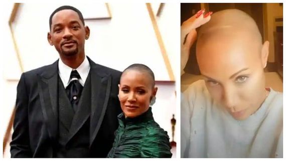 ವಿಲ್ ಸ್ಮಿತ್ ಪತ್ನಿಯ ಬೋಳು ತಲೆ ಬಗ್ಗೆ ಚರ್ಚೆ: ಕೂದಲು ಕತ್ತರಿಸಿಕೊಂಡಿದ್ದೇಕೆ ಜಾಡಾ?