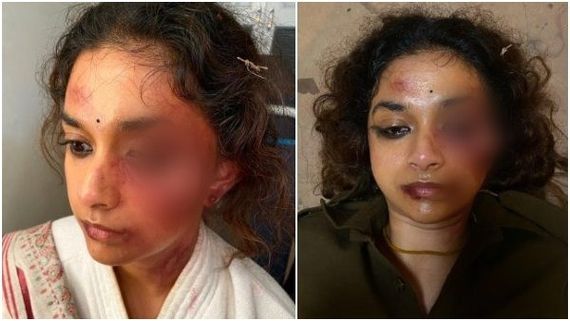 ಕೀರ್ತಿ ಸುರೇಶ್ ಮೇಲೆ ಹಲ್ಲೆ, ಫೋಟೊ ನೋಡಿ ಬೆಚ್ಚಿಬಿದ್ದ ಫ್ಯಾನ್ಸ್: ಇದು ರೀಲ್ or ರಿಯಲ್?