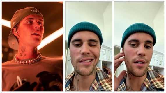 ಖ್ಯಾತ ಗಾಯಕ ಜಸ್ಟಿನ್ ಬೀಬರ್ ಗಂಭೀರ ಖಾಯಿಲೆ: ಹಾಡು ನಿಲ್ಲಿಸಿದ ಬೀಬರ್!