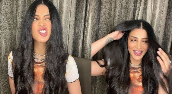 ನಟಿ ಶ್ರುತಿ ಹಾಸನ್‌ಗೆ ಆರೋಗ್ಯ ಸಮಸ್ಯೆ: ಬಹಿರಂಗ ಪೋಸ್ಟ್ ಹಂಚಿಕೊಂಡ ನಟಿ!