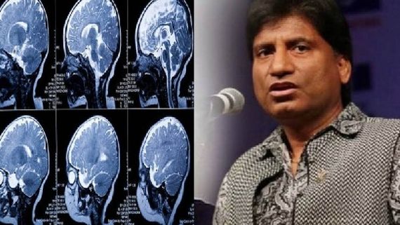 ರಾಜು ಶ್ರೀವತ್ಸವ್ ಮೆದುಳು ಕೆಲಸ ಮಾಡುತ್ತಿಲ್ಲ: ಆರೋಗ್ಯ ಮತ್ತಷ್ಟು ಗಂಭೀರ!