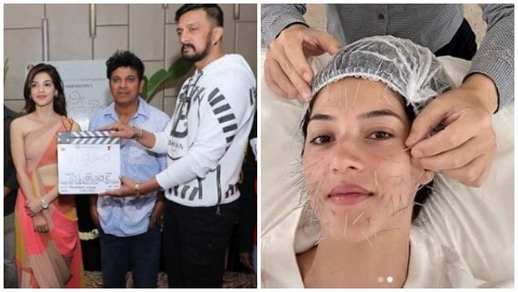 ಮೆಹ್ರೀನ್ ಮುಖದ ತುಂಬಾ ಸೂಜಿ: 'ನೀ ಸಿಗೋವರೆಗು' ಸಿನಿಮಾ ನಟಿಗೆ ಏನಾಯ್ತು?