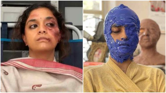 ಅಯ್ಯೋ ಮಹಾನಟಿಗೆ ಏನಾಯ್ತು? ಕೀರ್ತಿ ಸುರೇಶ್ ಇನ್‌ಸ್ಟಾಗ್ರಾಮ್ ಪೋಸ್ಟ್‌ ಫುಲ್ ವೈರಲ್