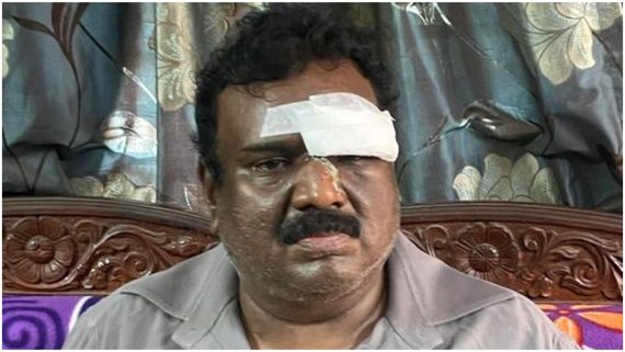 ಕಣ್ಣೇ ಹೋಗುತ್ತಿತ್ತು ; ಗೋವಾ ಗಲಾಟೆಯ ಬಗ್ಗೆ ಹೇಳಿದ್ದೇನು ನಿರ್ಮಾಪಕ ಎ. ಗಣೇಶ್..? 