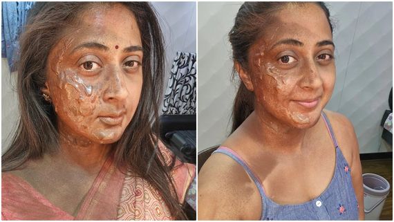 'ಅಣ್ಣಾವ್ರು' ಚಿತ್ರದ ನಾಯಕಿ ಮುಖಕ್ಕೆ ಏನಾಯ್ತು? ಫೋಟೊ ವೈರಲ್ 