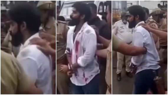 ಮೈಯೆಲ್ಲಾ ರಕ್ತ, ಯುವ ರಾಜ್‌ಕುಮಾರ್‌ಗೆ ಏನಾಯ್ತು? ವೀಡಿಯೋ ವೈರಲ್ 