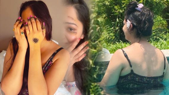 ನಾಯಿ ಜೊತೆ ವಾಕಿಂಗ್ ಹೋಗಿ ದೊಪ್ಪನೆ ಬಿದ್ದ ಬಿಗ್ ಬಾಸ್ ಸ್ಫರ್ಧಿ ; ಮುಖಕ್ಕೆ ಗಾಯ-ಕಣ್ಣೀರು ಹಾಕಿದ ಚೆಲುವೆ