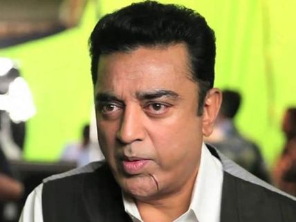 விஸ்வரூபம் 2: கமலுக்கு முதலில் உதட்டுக்கு கீழ், தற்போது காலில் காயம்