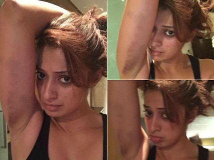 சண்டைக் காட்சியில் அடிபட்டேன்- பேஸ்புக்கில் ஸ்டேட்டஸ் போட்டு அனுதாபம் தேடிய ராய் லட்சுமி  