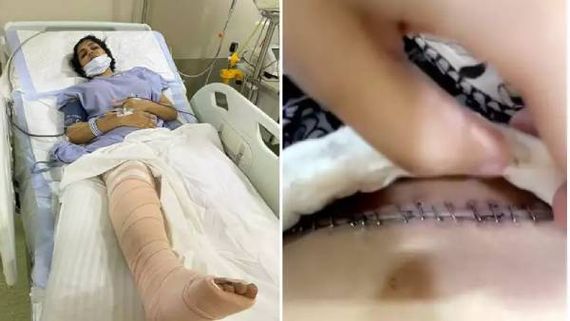 முதல் முறையாக யாஷிகா வெளியிட்ட சிகிச்சை வீடியோ...கதறி அழும் ரசிகர்கள் 