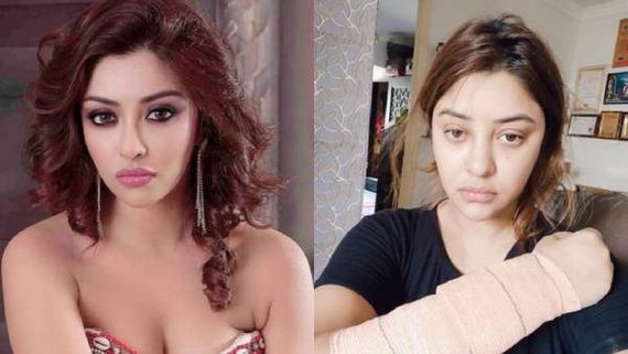 பிரபல நடிகையை இரும்பு ராடால் தாக்கிய கும்பல்.. ஆசிட் வீச்சில் இருந்து தப்பியதாக பரபரப்பு வீடியோ!