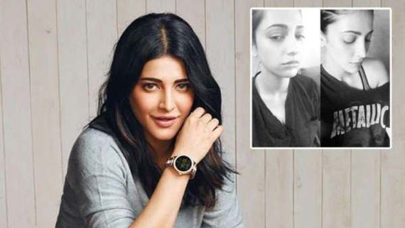 பிளாஸ்டிக் சர்ஜரியா?...ரசிகர் மீது பாய்ந்த ஸ்ருதி ஹாசன்